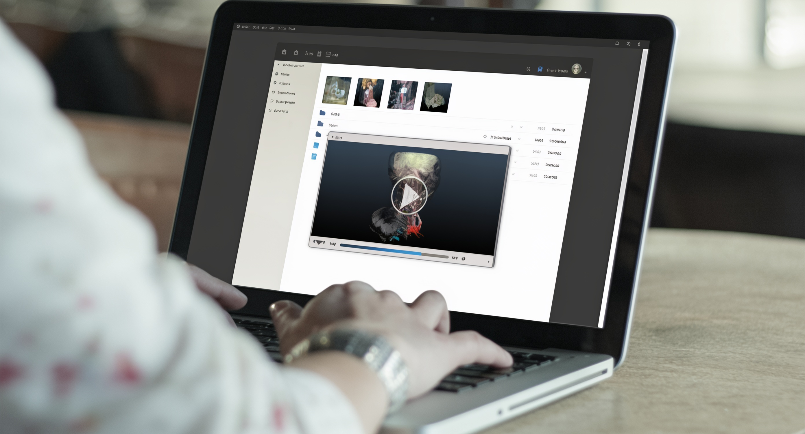 WebSeg – web-based segmentation platform for patient-specific 3D models