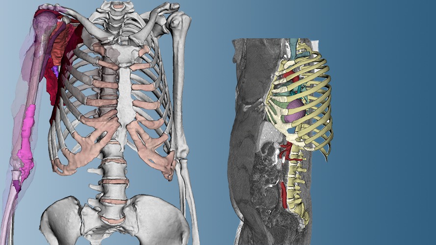Dornheim Real Anatomy