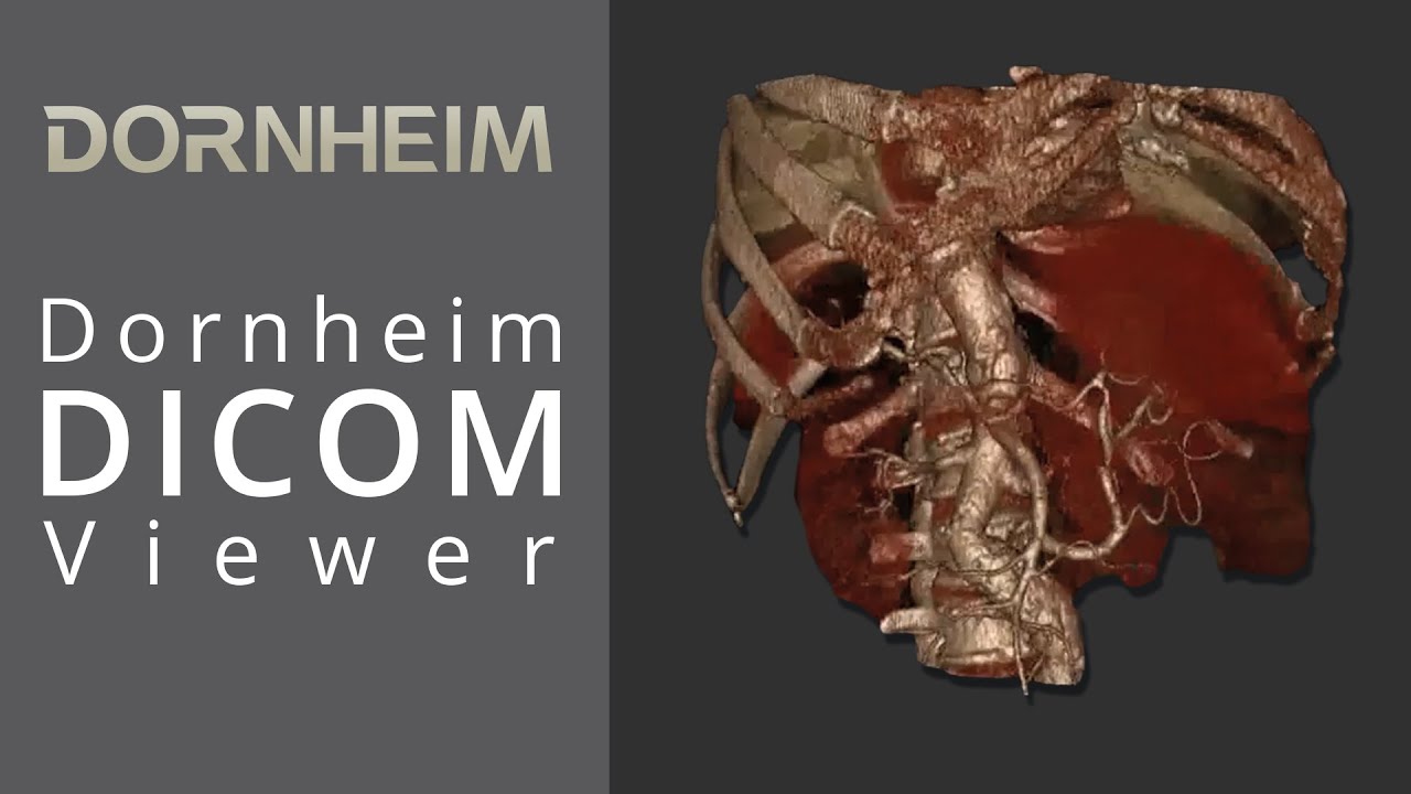 Dornheim DICOM Viewer
