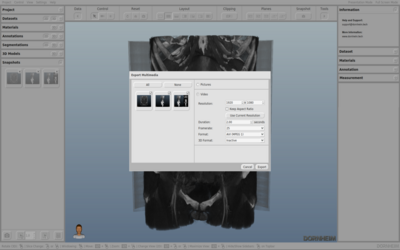 Video-Export