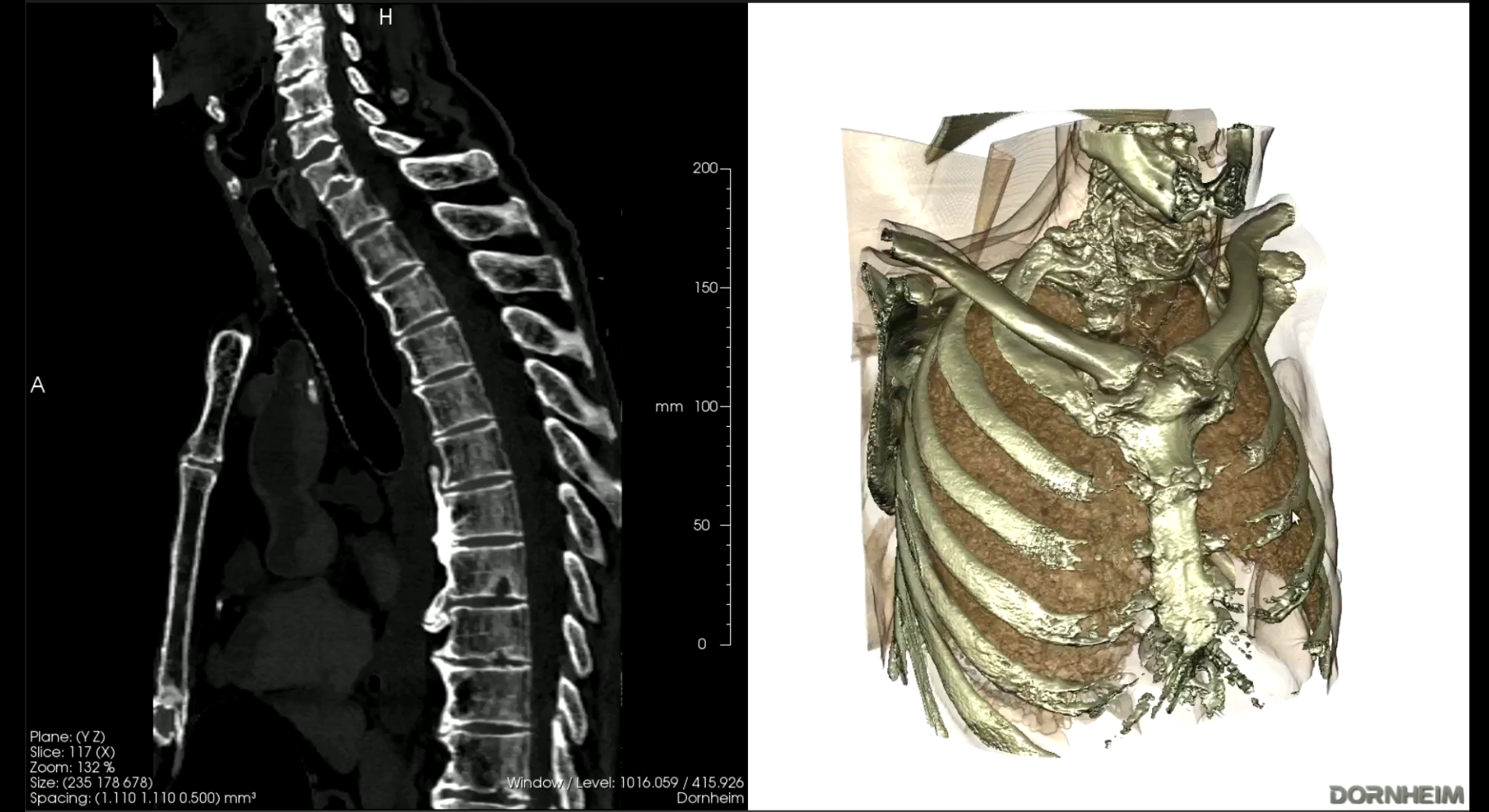 ge free dicom viewer ge free dicom viewer